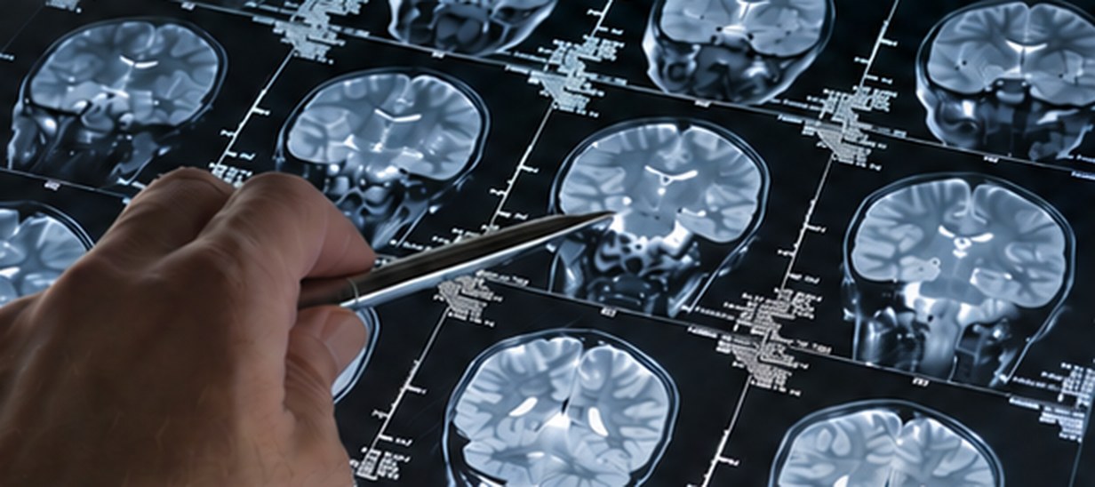 Reviewing MRI brain scans